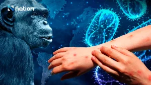 Wabah Mpox di Thailand: Loncatan Global Virus Kera
